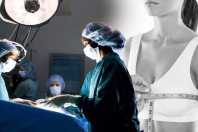 did 15000 indian women undergo breast reduction operations in 2021