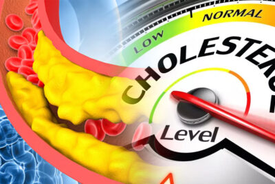 fitness myth skinny people dont have high cholesterol issues