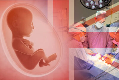 historic success first ever womb transplant in the uk marks a milestone in fertility treatment