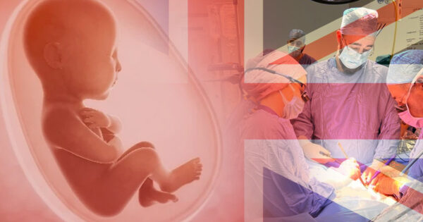 historic success first ever womb transplant in the uk marks a milestone in fertility treatment